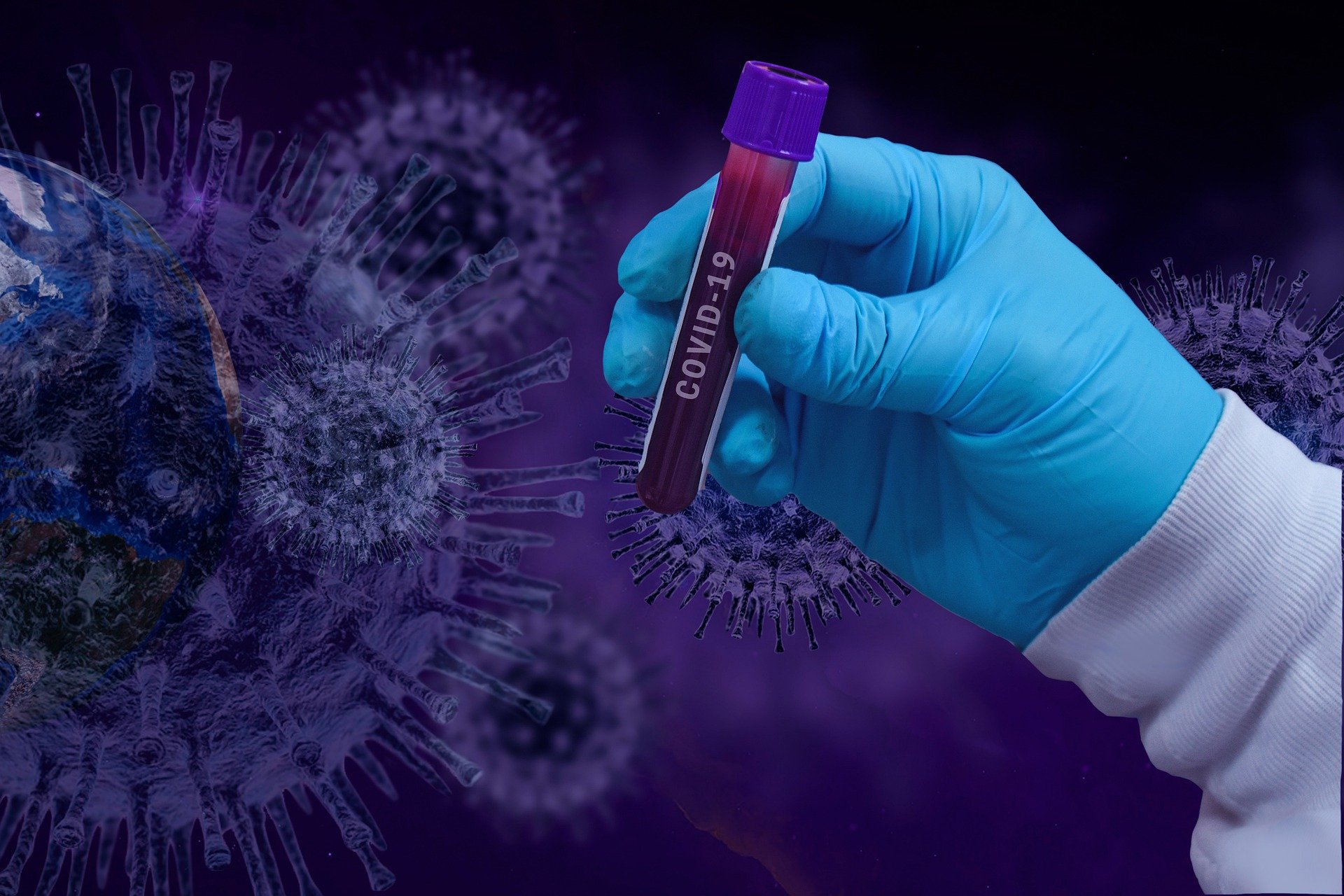 Śląski Uniwersystet Medyczny prowadzi badania SARS-CoV-2